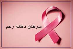سرطان دهانه رحم را بشناسیم